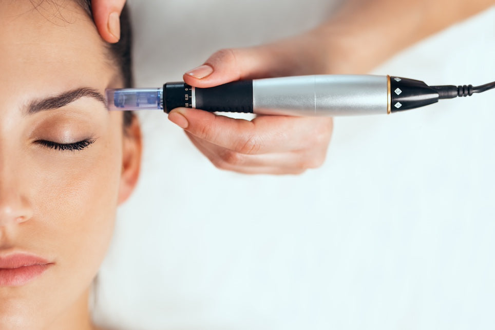 Cosmo Pen Microneedling